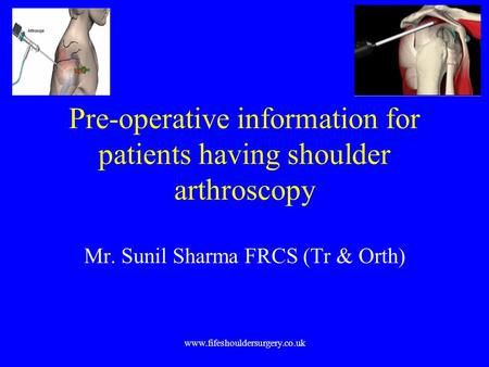 Www.fifeshouldersurgery.co.uk Pre-operative information for patients having shoulder arthroscopy Mr. Sunil Sharma FRCS (Tr & Orth)
