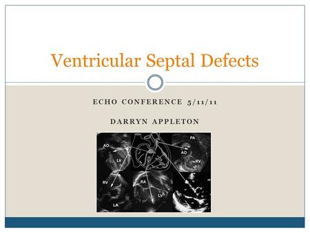 Ventricular Septal Defects