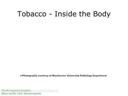 Tobacco - Inside the Body ©Photographs courtesy of Manchester University Pathology Department This Powerpoint is hosted on www.worldofteaching.comwww.worldofteaching.com.