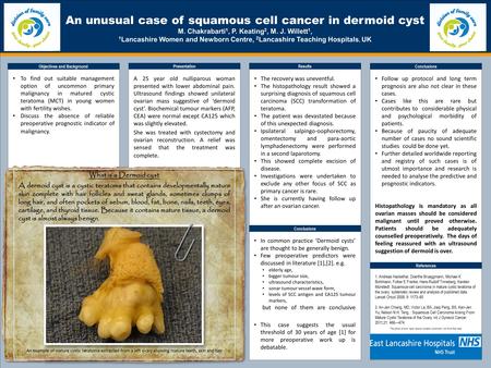 TEMPLATE DESIGN © 2008 www.PosterPresentations.com An unusual case of squamous cell cancer in dermoid cyst M. Chakrabarti 1, P. Keating 2, M. J. Willett.