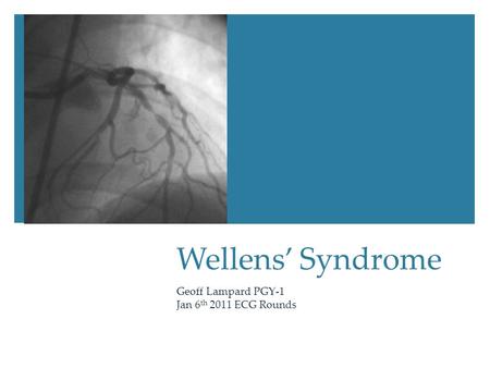 Wellens’ Syndrome Geoff Lampard PGY-1 Jan 6 th 2011 ECG Rounds.