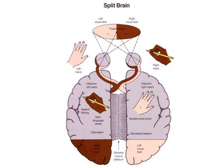 Split Brain Split brain patient. Split Brain Split brain patient.