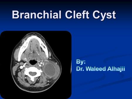 Branchial Cleft Cyst By: Dr. Waleed Alhajii.