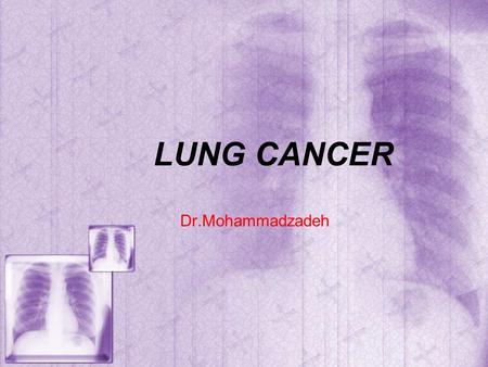 LUNG CANCER Dr.Mohammadzadeh. Lung cancer is the leading cancer killer in the United States. Every year, it accounts for 30% of all cancer deaths— more.