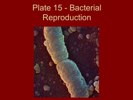 Plate 15 - Bacterial Reproduction. Sexual vs. Asexual Reproduction Asexual – no change in genetic makeup of daughter cells, all are identical Sexual –