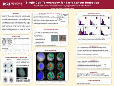 Single Cell Tomography for Early Cancer Detection Vivek Nandakumar, Laimonas Kelbauskas, Roger Johnson, Deirdre Meldrum Arizona State University, Tempe,