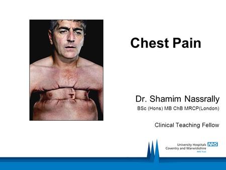 Chest Pain Dr. Shamim Nassrally BSc (Hons) MB ChB MRCP(London) Clinical Teaching Fellow.