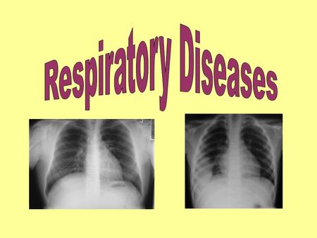 Normal Lung Tissue Name some diseases that affect the respiratory system: Asthma Bronchitis Lung cancer COPD Emphysema Pneumonia Pleuritis Common cold.