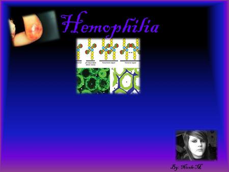 Hemophilia By: Nicole M What is the genetic cause of this disorder??? The genetic cause of this disorder is deletion.