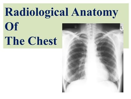 Radiological Anatomy Of The Chest