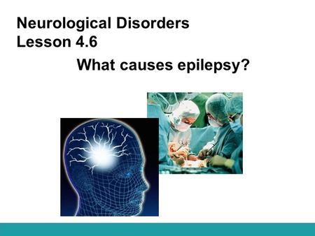 Neurological Disorders Lesson 4.6 What causes epilepsy?