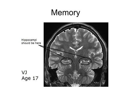 Memory. Encoding, Retrieval, and Recall Types of Memory (Explicit)(Implicit)