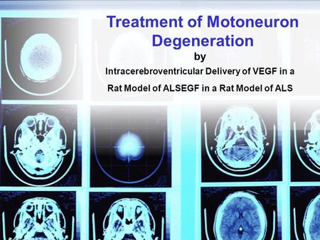 By Intracerebroventricular Delivery of VEGF in a Rat Model of ALSEGF in a Rat Model of ALS Treatment of Motoneuron Degeneration.