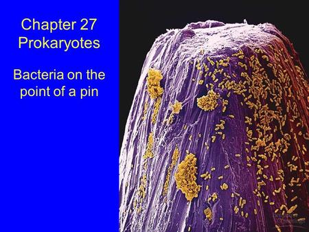 Chapter 27 Prokaryotes Bacteria on the point of a pin.