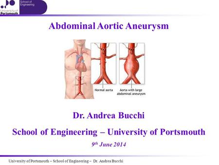 Abdominal Aortic Aneurysm Dr. Andrea Bucchi School of Engineering – University of Portsmouth 9 th June 2014 University of Portsmouth – School of Engineering.