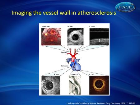 Lindsay and Choudhury, Nature Reviews: Drug Discovery 2008, 7: 517-29 Imaging the vessel wall in atherosclerosis.