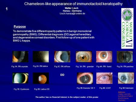 Chameleon-like appearance of immunotactoid keratopathy To demonstrate five different opacity patterns in benign monoclonal gammopathy (BMG). Differential.