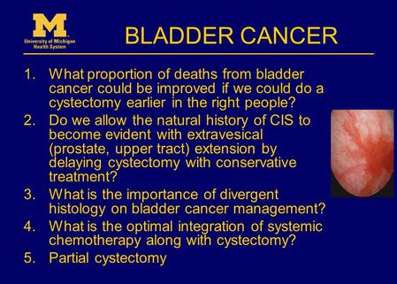 BLADDER CANCER 1.What proportion of deaths from bladder cancer could be improved if we could do a cystectomy earlier in the right people? 2.Do we allow.