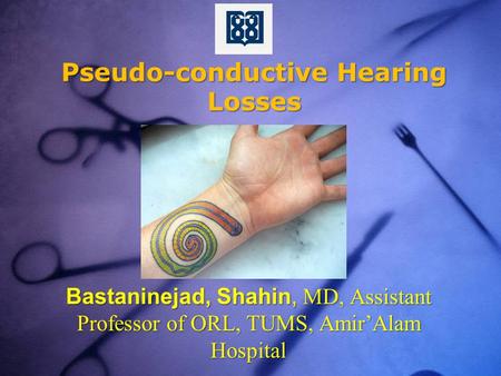 Pseudo-conductive Hearing Losses