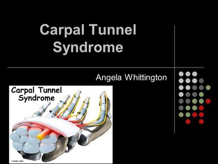 Carpal Tunnel Syndrome Angela Whittington. Definition: CTS Median nerve compression Nerve passes under the transverse carpal ligament and through carpal.
