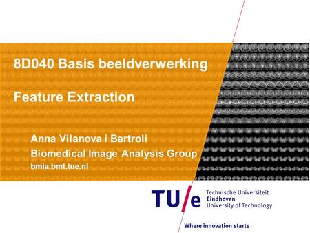 8D040 Basis beeldverwerking Feature Extraction Anna Vilanova i Bartrolí Biomedical Image Analysis Group bmia.bmt.tue.nl.