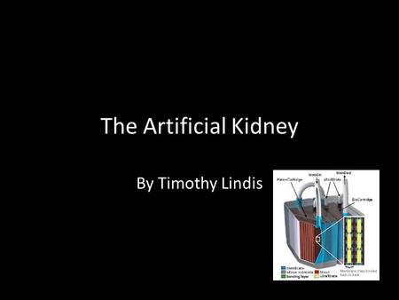 The Artificial Kidney By Timothy Lindis. The Kidneys Pair of small organs located in lower back Play crucial role in urinary system Other functions include.
