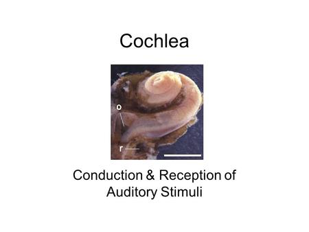 Cochlea Conduction & Reception of Auditory Stimuli.
