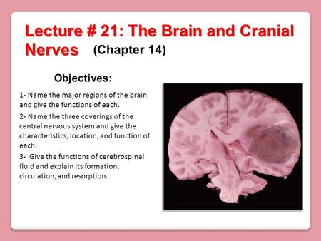 Lecture # 21: The Brain and Cranial Nerves