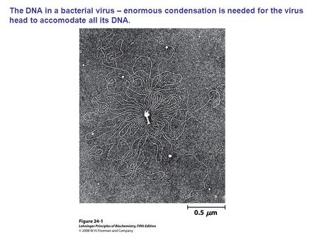 The DNA in a bacterial virus – enormous condensation is needed for the virus head to accomodate all its DNA.
