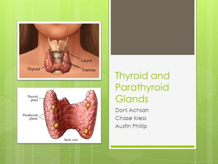 Thyroid and Parathyroid Glands Doni Achsan Chase Kress Austin Phillip.