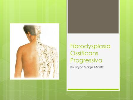 Fibrodysplasia Ossificans Progressiva By Bryor Gage Moritz.