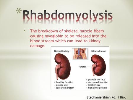 The breakdown of skeletal muscle fibers causing myoglobin to be released into the blood stream which can lead to kidney damage. Stephanie Shinn Pd. 1 Bio.