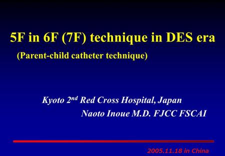 5F in 6F (7F) technique in DES era (Parent-child catheter technique)