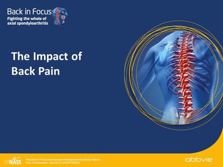 This Back in Focus resource was developed and funded by AbbVie.. Date of preparation: June 2015; AXHUR150807p The Impact of Back Pain.