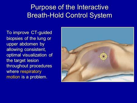 Purpose of the Interactive Breath-Hold Control System To improve CT-guided biopsies of the lung or upper abdomen by allowing consistent, optimal visualization.
