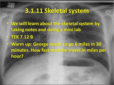 3.1.11 Skeletal system We will learn about the skeletal system by taking notes and doing a mini lab We will learn about the skeletal system by taking notes.