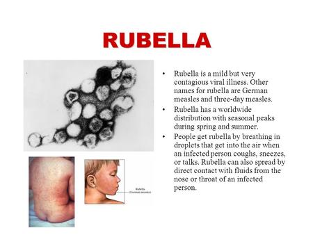 RUBELLA Rubella is a mild but very contagious viral illness. Other names for rubella are German measles and three-day measles. Rubella has a worldwide.