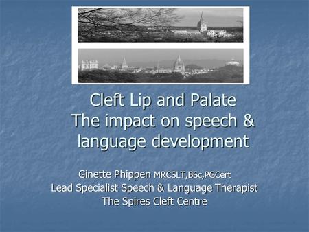 Cleft Lip and Palate The impact on speech & language development Ginette Phippen MRCSLT,BSc,PGCert Lead Specialist Speech & Language Therapist The Spires.