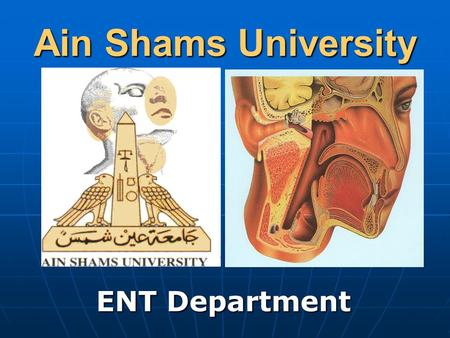 Ain Shams University ENT Department. The Ear Trauma to External Ear Haematoma Auris It is collection of blood under auricular perichondrium. It is collection.