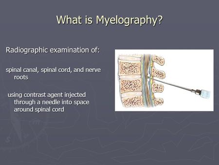 What is Myelography? Radiographic examination of: spinal canal, spinal cord, and nerve roots using contrast agent injected through a needle into space.