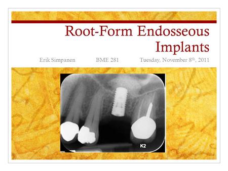 Root-Form Endosseous Implants Erik Simpanen BME 281 Tuesday, November 8 th, 2011.