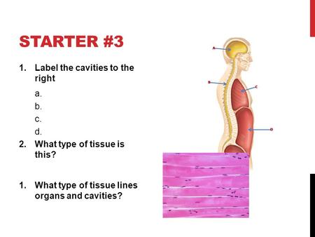 STARTER #3 1.Label the cavities to the right a. b. c. d. 2.What type of tissue is this? 1.What type of tissue lines organs and cavities?
