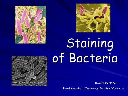 Staining of Bacteria Staining of Bacteria Brno University of Technology, Faculty of Chemistry Hana ŠURANSKÁ.
