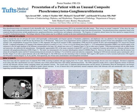 Presentation of a Patient with an Unusual Composite Pheochromocytoma-Ganglioneuroblastoma Iqra Javeed MD 1, Arthur S Tischler MD 2, Michael E Tarnoff MD.