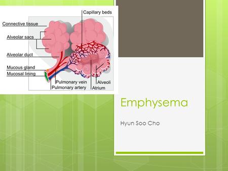 Emphysema Hyun Soo Cho. What is Emphysema  A lung disease that the lung keep expands because of the carbon dioxide. When a person breathes in, the lung.