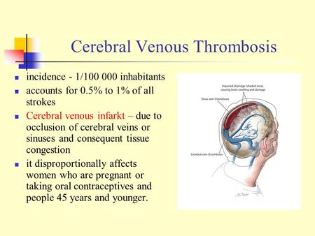 Cerebral Venous Thrombosis incidence - 1/100 000 inhabitants accounts for 0.5% to 1% of all strokes Cerebral venous infarkt – due to occlusion of cerebral.