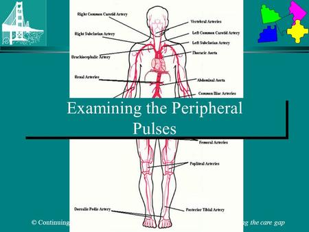 Examining the Peripheral Pulses