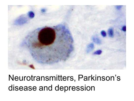 Neurotransmitters, Parkinson’s disease and depression