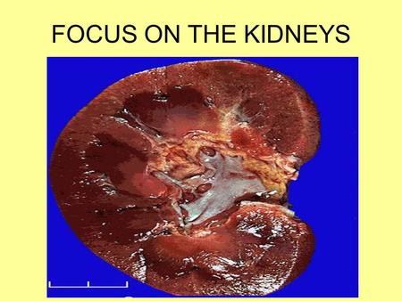 FOCUS ON THE KIDNEYS. Functions: Filter wastes : Every day, kidneys process about 200 quarts of blood to filter out about 2 quarts of waste products and.