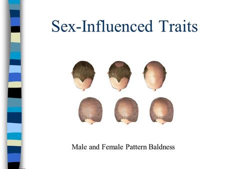 Sex-Influenced Traits Male and Female Pattern Baldness.